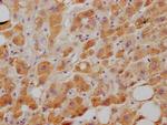 NPC1L1 Antibody in Immunohistochemistry (Paraffin) (IHC (P))