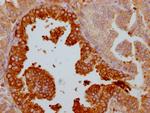 Lactoferrin Antibody in Immunohistochemistry (Paraffin) (IHC (P))