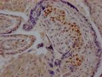 SKP2 Antibody in Immunohistochemistry (Paraffin) (IHC (P))