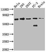 LTA4H Antibody in Western Blot (WB)