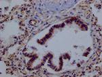 PRDX3 Antibody in Immunohistochemistry (Paraffin) (IHC (P))