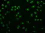 USP22 Antibody in Immunocytochemistry (ICC/IF)