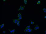 Aconitase 1 Antibody in Immunocytochemistry (ICC/IF)