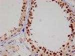 SENP1 Antibody in Immunohistochemistry (Paraffin) (IHC (P))