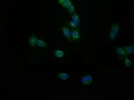 JNK3 Antibody in Immunocytochemistry (ICC/IF)