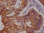 FADS1 Antibody in Immunohistochemistry (Paraffin) (IHC (P))