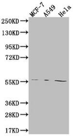 FADS1 Antibody in Western Blot (WB)