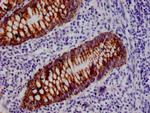 HMGCS2 Antibody in Immunohistochemistry (Paraffin) (IHC (P))