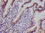 HMGCS2 Antibody in Immunohistochemistry (Paraffin) (IHC (P))