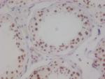 MYST1 Antibody in Immunohistochemistry (Paraffin) (IHC (P))