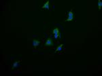 PAH Antibody in Immunocytochemistry (ICC/IF)