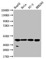 NSDHL Antibody in Western Blot (WB)