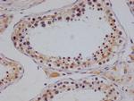 NTHL1 Antibody in Immunohistochemistry (Paraffin) (IHC (P))