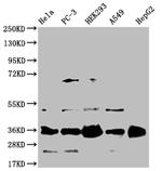 HMGCL Antibody in Western Blot (WB)