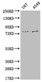 SLC25A12 Antibody in Western Blot (WB)