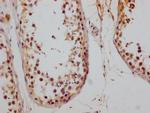 CD147 Antibody in Immunohistochemistry (Paraffin) (IHC (P))