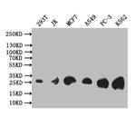 TK1 Antibody in Western Blot (WB)