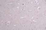 Phospho-Tau (Ser214) Antibody in Immunohistochemistry (Paraffin) (IHC (P))