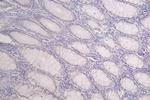 Cardiac Troponin T Antibody in Immunohistochemistry (Paraffin) (IHC (P))