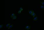 ATP7B Antibody in Immunocytochemistry (ICC/IF)