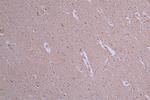 ATP7B Antibody in Immunohistochemistry (Paraffin) (IHC (P))