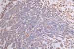 ATP7B Antibody in Immunohistochemistry (Paraffin) (IHC (P))