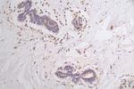 VEGF Receptor 1 Antibody in Immunohistochemistry (Paraffin) (IHC (P))