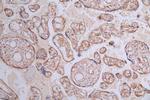 VEGF Receptor 1 Antibody in Immunohistochemistry (Paraffin) (IHC (P))