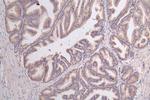 GPI Antibody in Immunohistochemistry (Paraffin) (IHC (P))