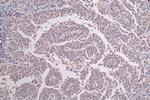 DDB2 Antibody in Immunohistochemistry (Paraffin) (IHC (P))