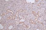 DDB2 Antibody in Immunohistochemistry (Paraffin) (IHC (P))