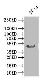 DDB2 Antibody in Western Blot (WB)