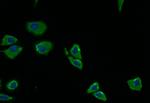 PRKAR2A Antibody in Immunocytochemistry (ICC/IF)