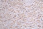 PRKAR2A Antibody in Immunohistochemistry (Paraffin) (IHC (P))