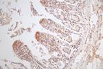 MICA Antibody in Immunohistochemistry (Paraffin) (IHC (P))