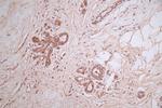 HSD3B1 Antibody in Immunohistochemistry (Paraffin) (IHC (P))