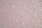 AKT Pan Antibody in Immunohistochemistry (Paraffin) (IHC (P))