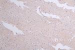 WNK1 Antibody in Immunohistochemistry (Paraffin) (IHC (P))