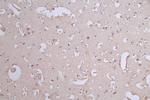 Paxillin Antibody in Immunohistochemistry (Paraffin) (IHC (P))