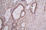 PI3K p85 alpha Antibody in Immunohistochemistry (Paraffin) (IHC (P))