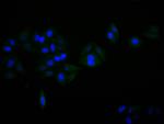 alpha Synuclein Antibody in Immunocytochemistry (ICC/IF)