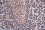 TK1 Antibody in Immunohistochemistry (Paraffin) (IHC (P))