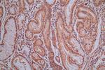 ROBO1 Antibody in Immunohistochemistry (Paraffin) (IHC (P))