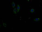 Phospho-PERK (Thr981) Antibody in Immunocytochemistry (ICC/IF)