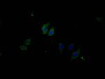 Phospho-PERK (Thr981) Antibody in Immunocytochemistry (ICC/IF)