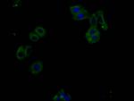 Phospho-PERK (Thr981) Antibody in Immunocytochemistry (ICC/IF)