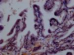 SMURF1 Antibody in Immunohistochemistry (Paraffin) (IHC (P))