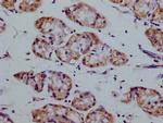 SMURF1 Antibody in Immunohistochemistry (Paraffin) (IHC (P))