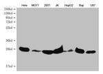 PRDX3 Antibody in Western Blot (WB)