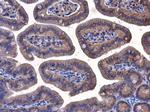 beta Catenin Antibody in Immunohistochemistry (Paraffin) (IHC (P))